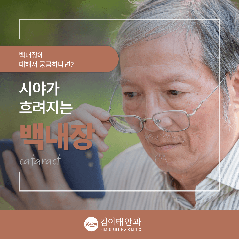 천안 백내장 수술 시기와 인공수정체 선택, 4단계 과정 총정리