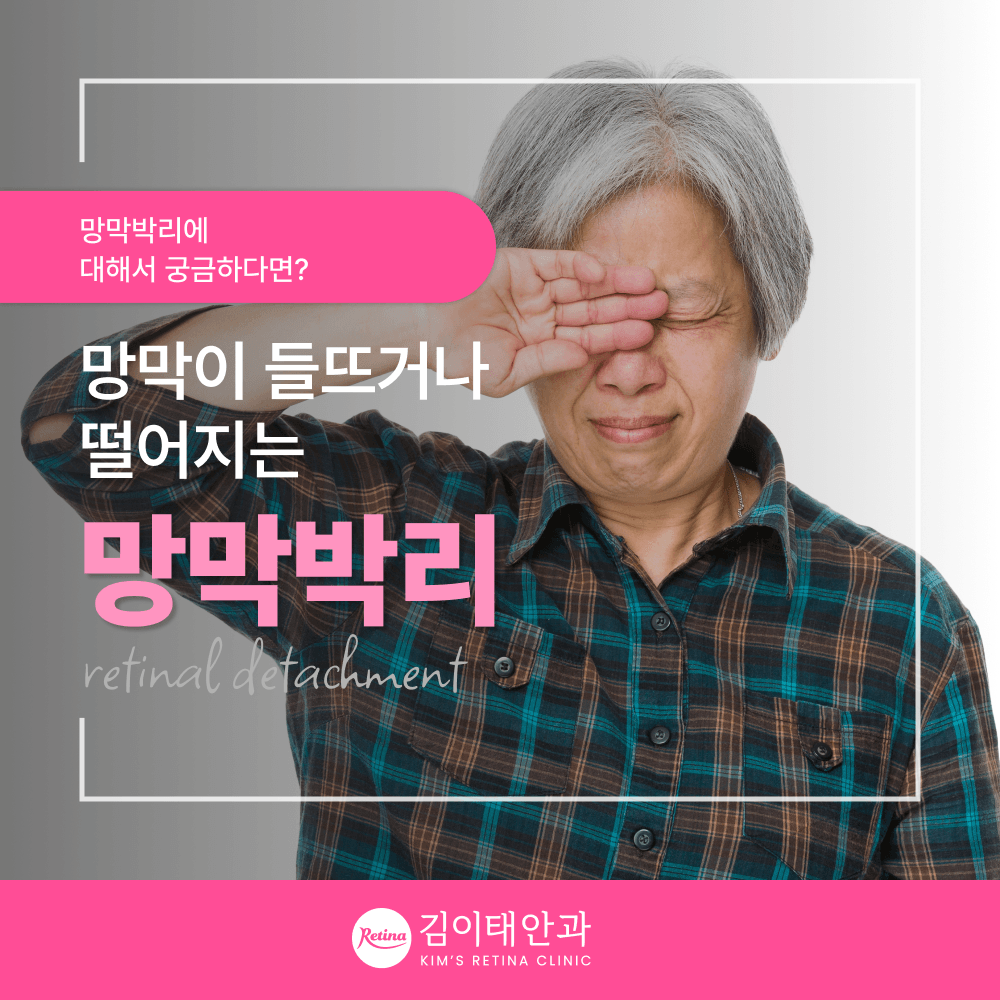 천안안과 망막질환 8가지와 망막검사 기준 4단계 진료 과정 | 김이태안과