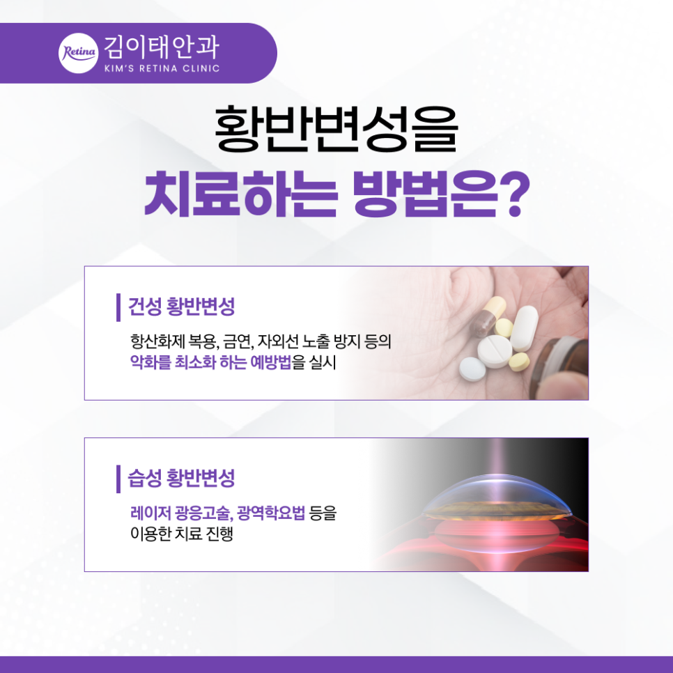 천안망막질환 정기검진과 생활관리 안내