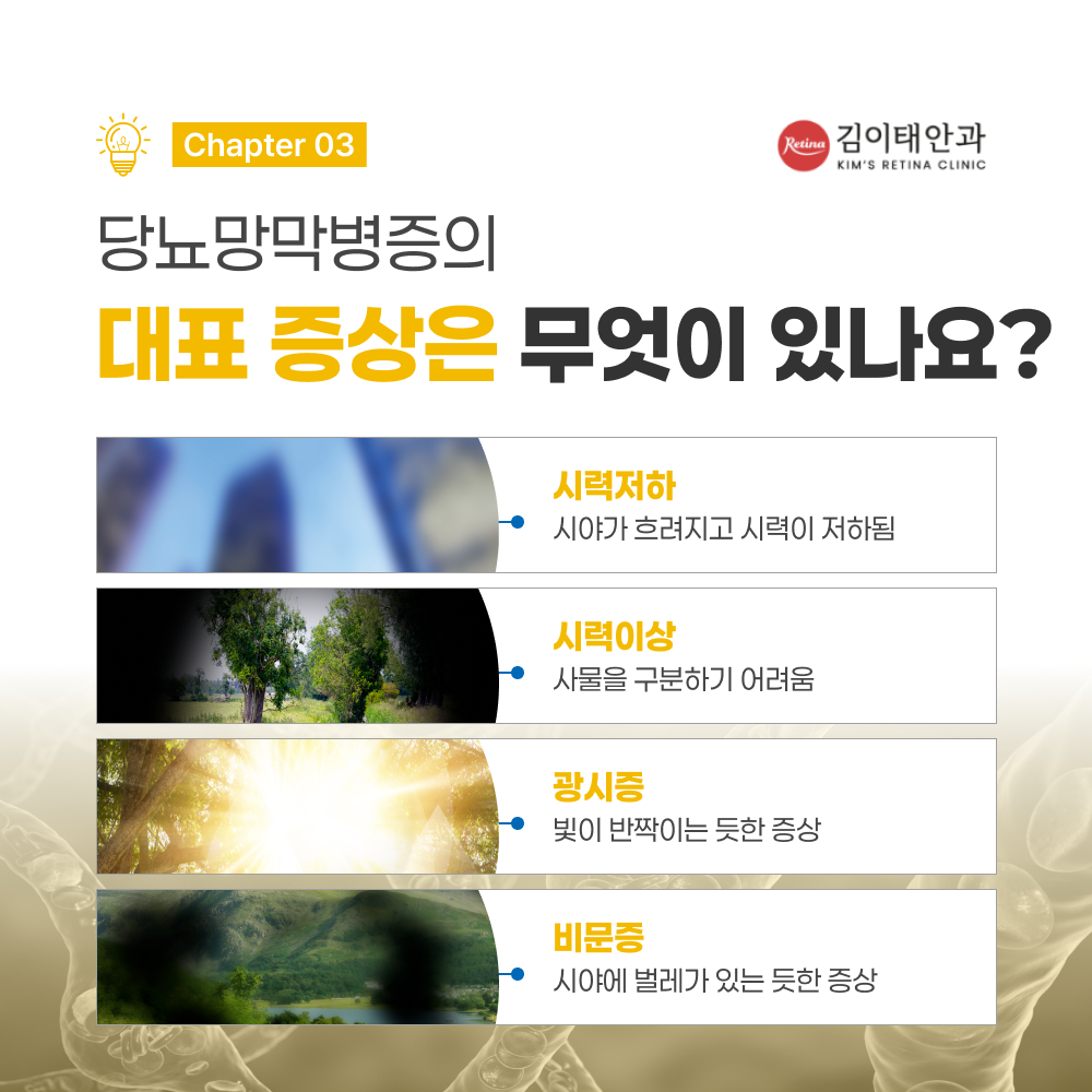 천안망막수술 및 치료 방법 안내 4