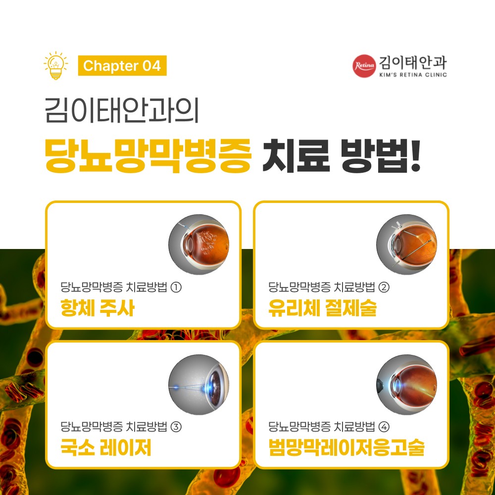 천안 망막병원 김이태안과 진료 안내 5