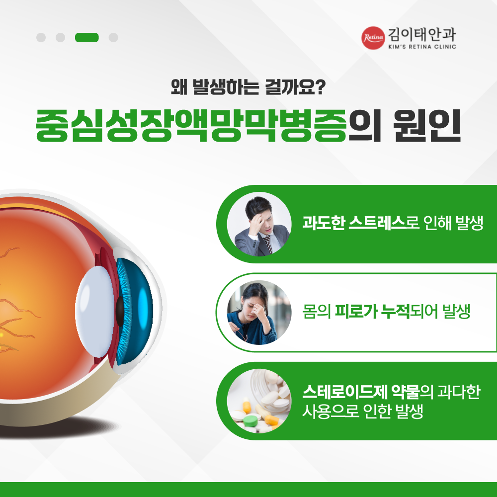 천안 마이크로펄스 레이저 치료 안내 4