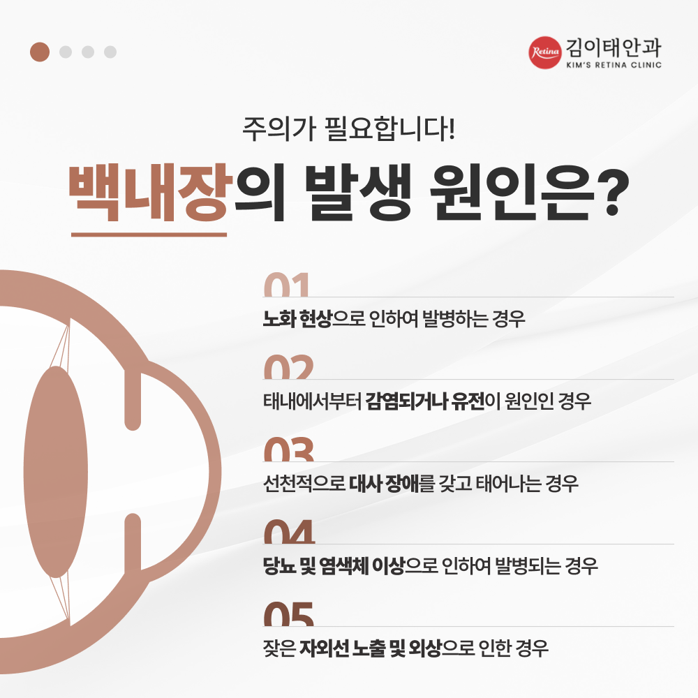 천안 백내장 검사 장비 안내 3